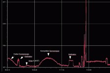 Scan der Milchstr. mit dem Radioteleskop